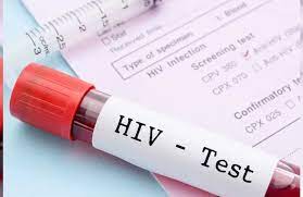 HIV Nedir Ve Hangi Yollarla Bulaşır